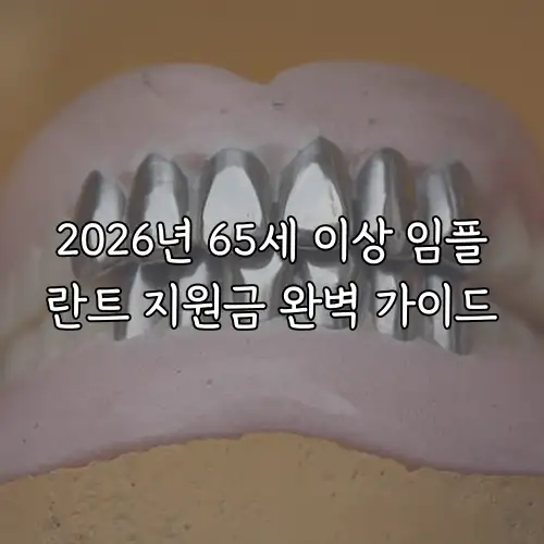 2026년 65세 이상 임플란트 지원금 완벽 가이드